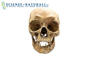 Un nuovo metodo per stabilire il colore degli occhi e dei capelli da campioni forensi attuali può essere utilizzato anche per identificare caratteristiche fisiche da antichi resti umani  (da Sciencedaily)